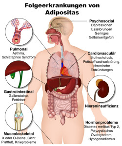 Folgen von Adipositas