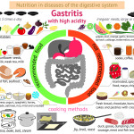 Infografik Gastritis - diese Nahrung ist zu empfehlen