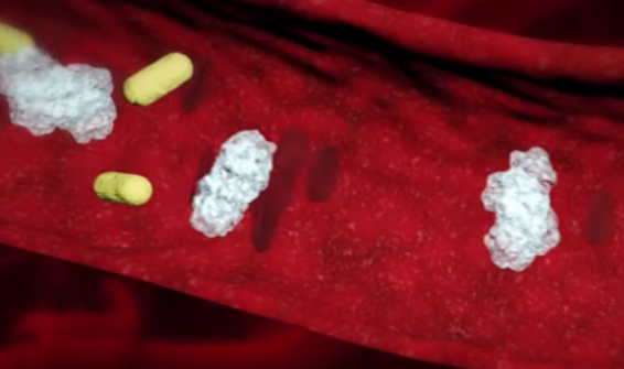 Blutvergiftungen (Sepsis) - Ursachen, Symptome, Diagnose & Behandlung ...