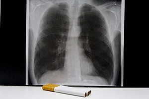 Rauchen aufgehort bronchien schmerzen