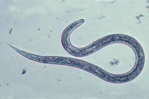 Im klo würmer Gesundheit: würmer