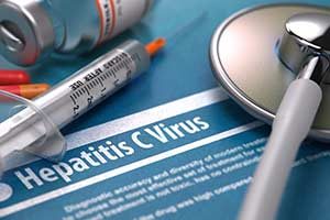 Hepatitis C HCV