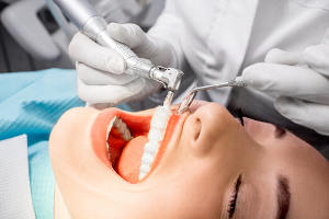 Behandlung Professionelle Zahnreinigung
