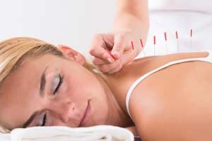 Akupunktur behandlung