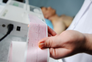 Behandlung Kardiologie EKG Elektrokardiogramm
