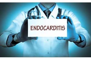 Herzinnenhautentzündung, endokarditis, endocarditis