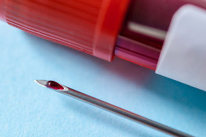 Behandlung Blutbild Kanüle Hepatitis C Blutkultur