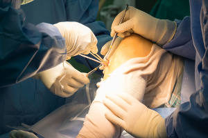 Behandlung Arthroskopie