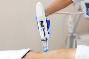 Behandlung Mesotherapie