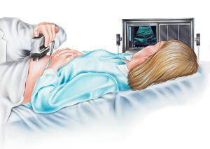 Behandlung Nackentransparenzmessung