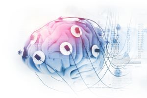 Behandlung Neurofeedback