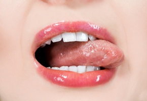 Krankheiten eingerissene Mundwinkel