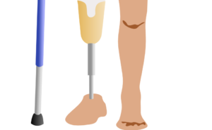 amputation prothese bein krücke behinderung