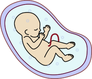 embryo baby geburt schwanger shunt 
