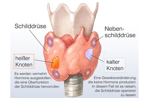 Nebenschilddrüse Schilddrüse Hormone Hals