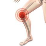 Knie, Kniescheibe, Gelenke, Oberschenkel, Unterschenkel, Waden Knieschmerzen, Arthrose, Arthritis