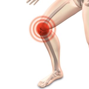Knie, Kniescheibe, Gelenke, Oberschenkel, Unterschenkel, Waden Knieschmerzen, Arthrose, Arthritis