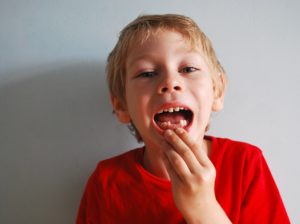 milchzähne , ohne , junge , mund , anzeigen , fehlt , zähne , glücklich , wächst, zahnen, durchbruch, zahndurchbruss, milchzahndurchbruch