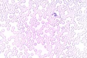 blut , neutrophile , segmentierte neutrophile , granulozyten , blutkörperchen , labor , mikroskop , hämatologie , leukozyten , weiße blutkörperchen , erythrozyten , rote blutkörperchen