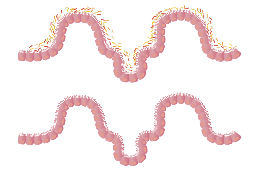 Absorption erklärt! Funktion, Aufgabe, Krankheiten & Störung » Krank.de
