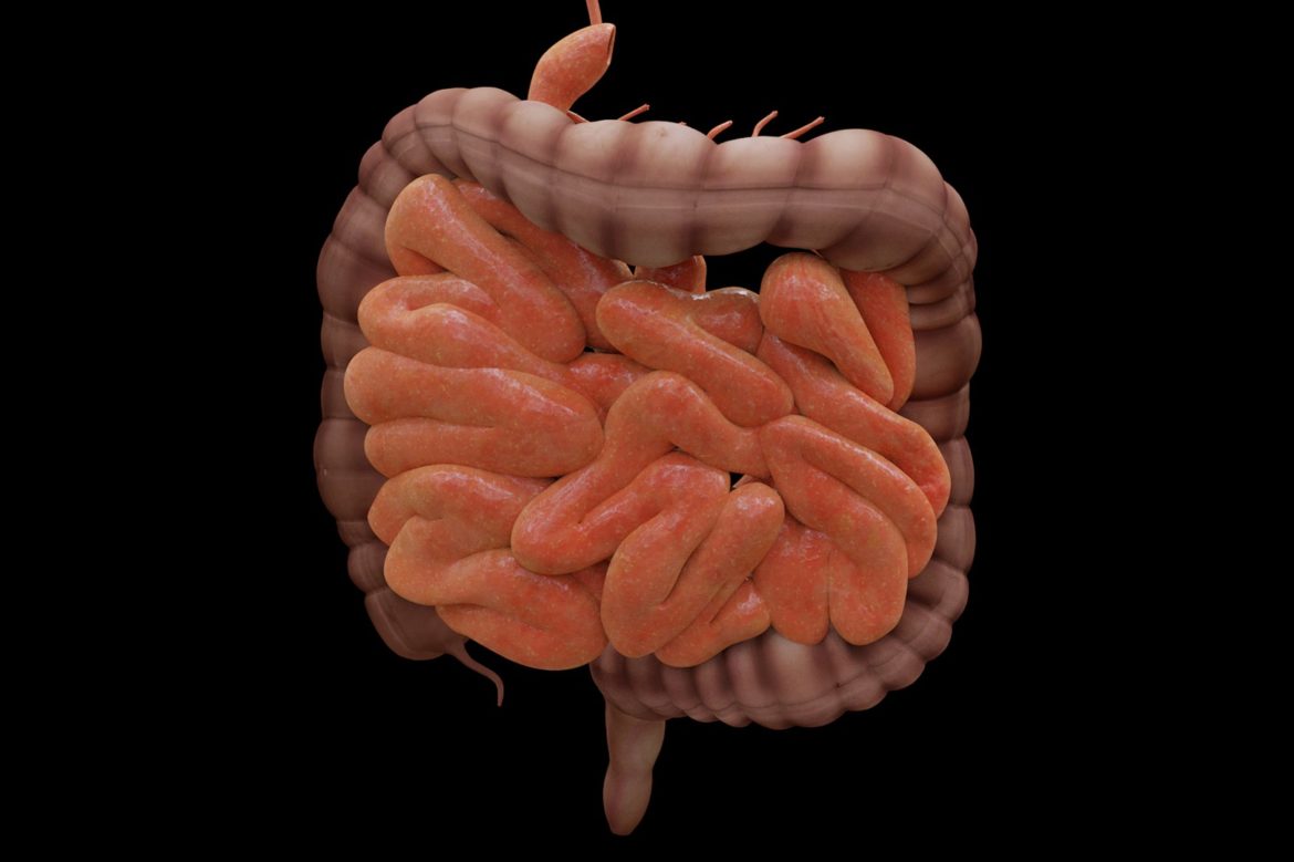 Was ist eine Hernie? - Ursachen, Symptome, Behandlung » Krank.de