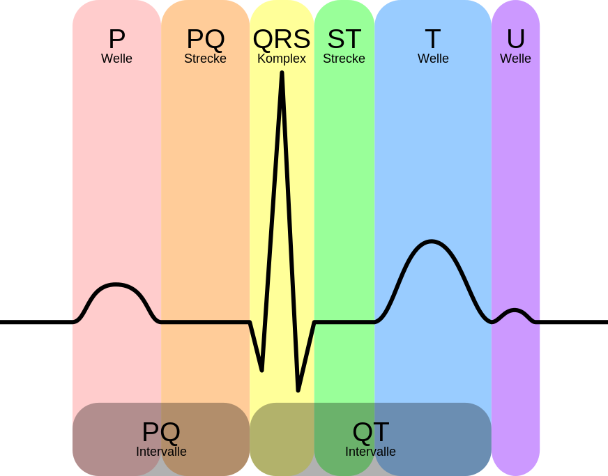 Elektrokardiogramm (EKG) erklärt! Ablauf, Auswertung, Gründe » Krank.de